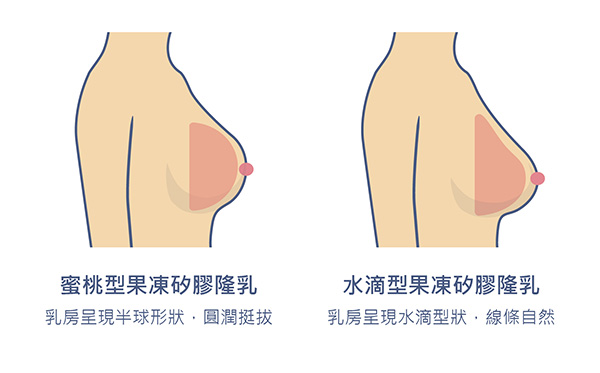 æåç½è éä¹³