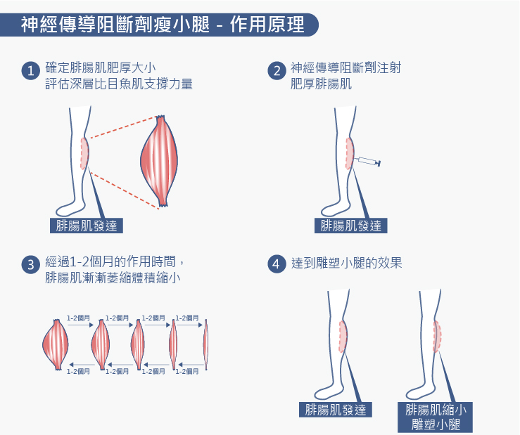 IPL脈衝光雷射作用原理