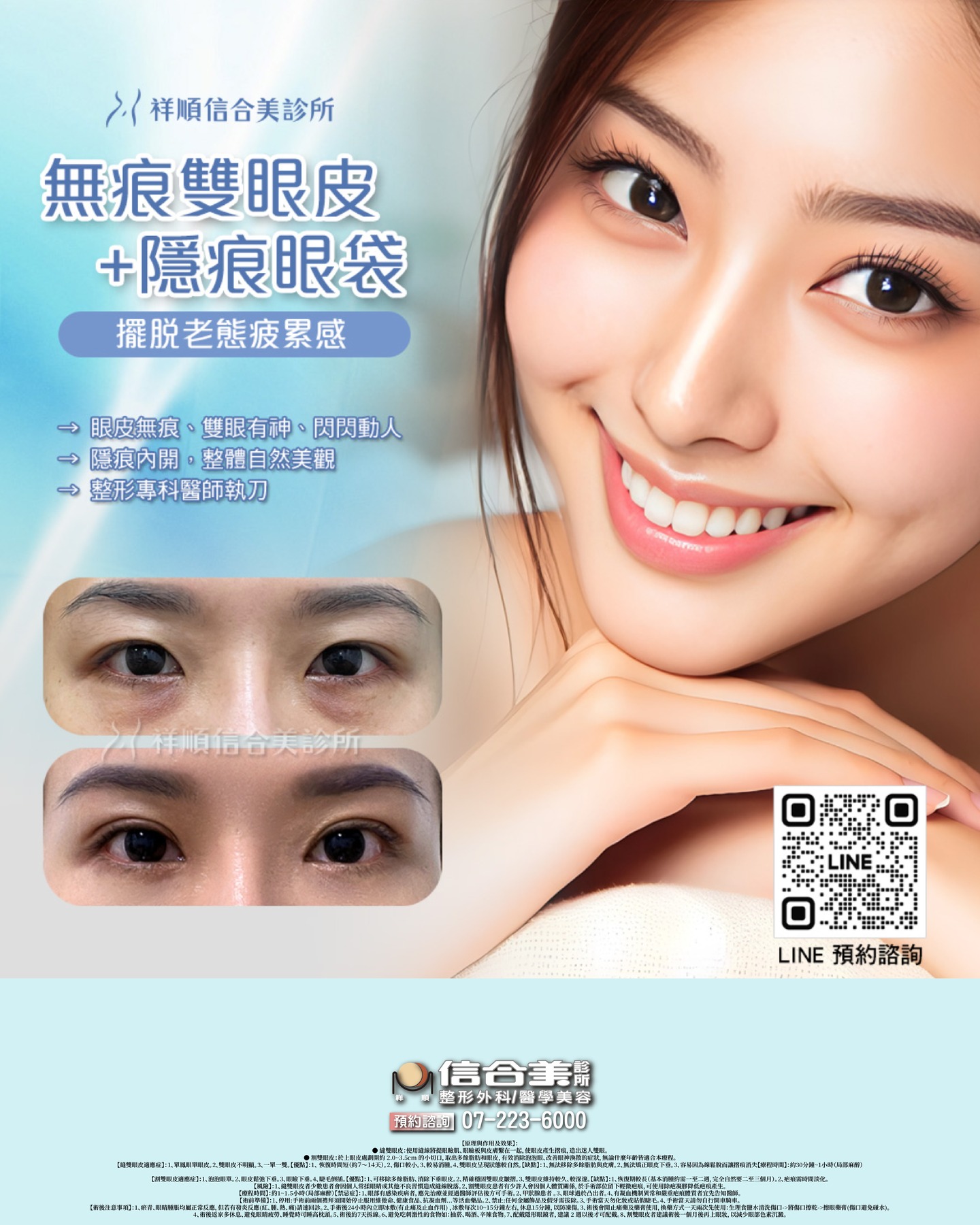 無痕雙眼皮+隱痕眼袋