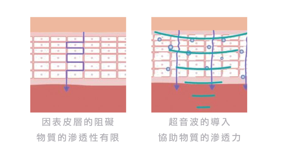 geneo泡泡電波