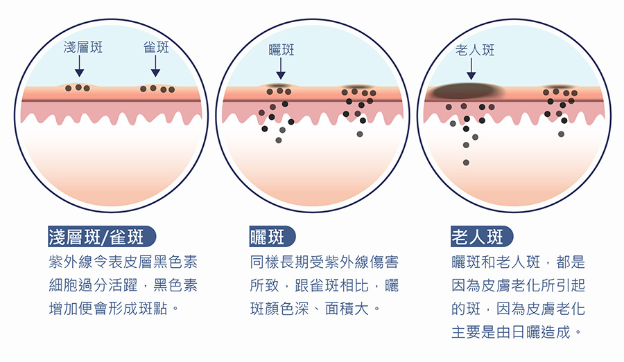 銣雅鉻雷射作用原理