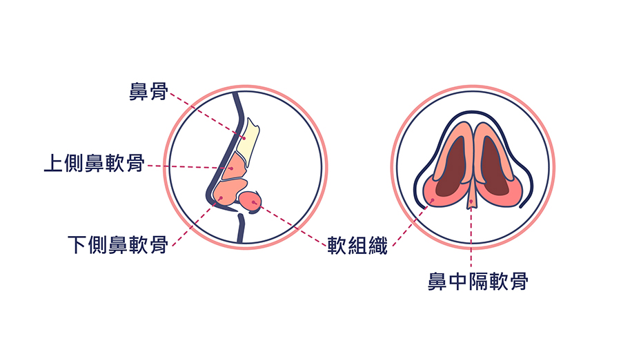 韓式隆鼻