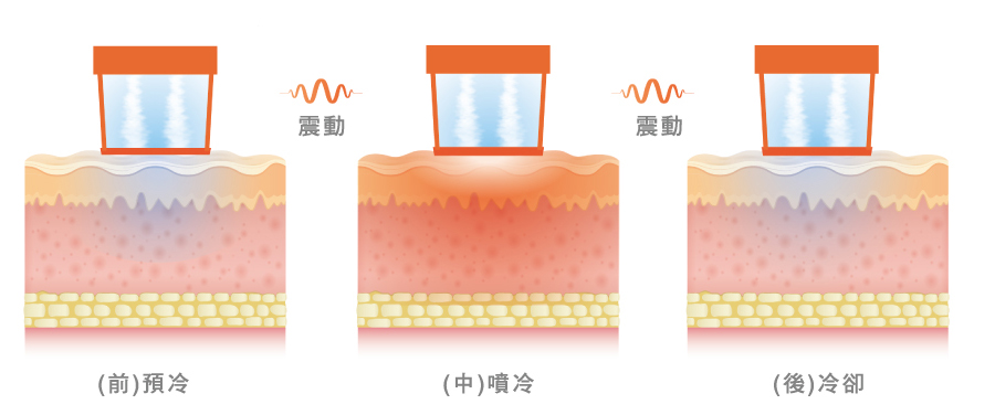 Oligio電波(玩美電波)