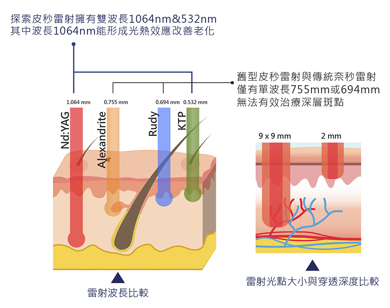 義大利探索皮秒雷射